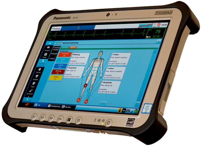 Ortivus PG1-1 Patient Monitor